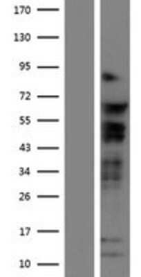 Western Blot: TCF7L2 Overexpression Lysate [NBP2-10154]