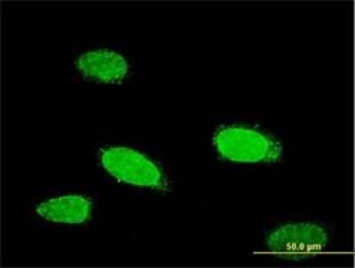 Immunocytochemistry/ Immunofluorescence: TCFL5 Antibody (1F2) [H00010732-M01]