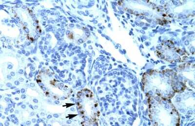 Immunohistochemistry: TCFL5 Antibody [NBP2-88424]