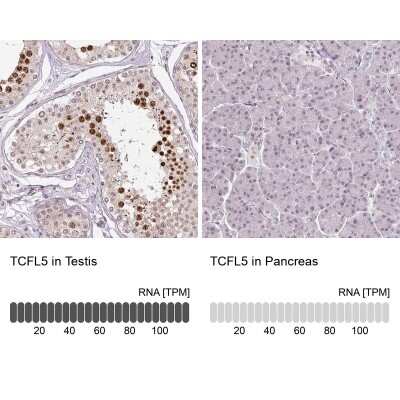 Immunohistochemistry-Paraffin: TCFL5 Antibody [NBP2-49174]