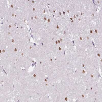 Immunohistochemistry-Paraffin: TCFL5 Antibody [NBP2-49174]