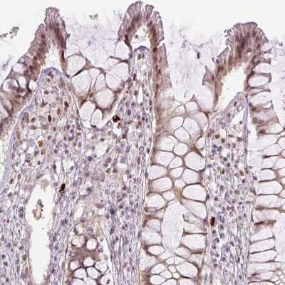 Immunohistochemistry-Paraffin: TCFL5 Antibody [NBP2-49174]