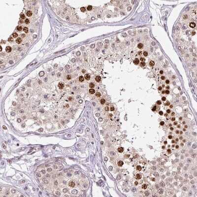 Immunohistochemistry-Paraffin: TCFL5 Antibody [NBP2-49174]