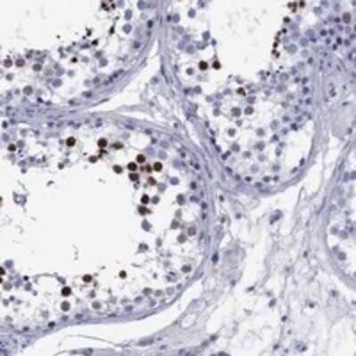 Immunohistochemistry-Paraffin: TCFL5 Antibody [NBP3-17945]