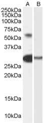 Western Blot: TCFL5 Antibody [NB100-53800]