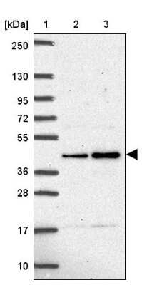 Western Blot: TCFL5 Antibody [NBP2-49174]