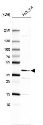 Western Blot: TCFL5 Antibody [NBP2-49174]