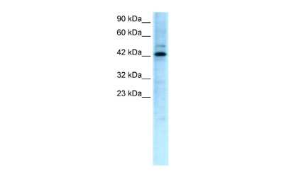 Western Blot: TCFL5 Antibody [NBP2-88424]