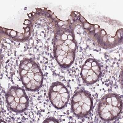 Immunohistochemistry: TCHP Antibody [NBP2-49340]