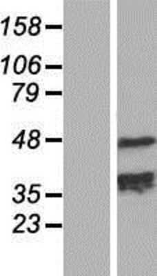 Western Blot: TCHP Overexpression Lysate [NBP2-06052]