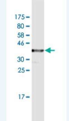 Western Blot: TCIRG1 Antibody (7H20) [H00010312-M02]