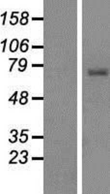 Western Blot: TCIRG1 Overexpression Lysate [NBP2-09827]