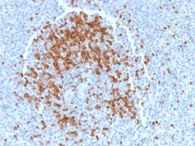 Immunohistochemistry-Paraffin: TCL1A Antibody (TCL1/2078) - Azide and BSA Free [NBP2-75750]