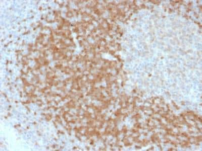 Immunohistochemistry-Paraffin: TCL1A Antibody (TCL1/2078) - Azide and BSA Free [NBP2-75750]