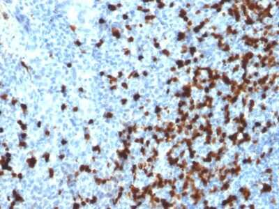 Immunohistochemistry-Paraffin: TCL1A Antibody (TCL1/2079) [NBP3-11311]