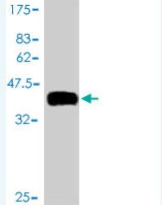 Western Blot: TCL1B Antibody (2A12) [H00009623-M01]