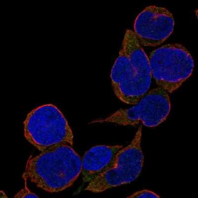 Immunocytochemistry/ Immunofluorescence: TCL1B Antibody [NBP2-47608]