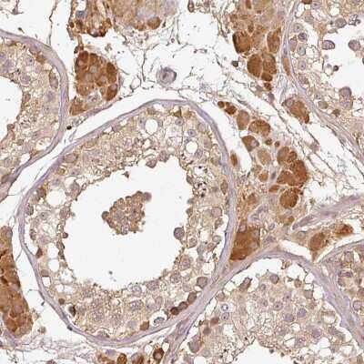 Immunohistochemistry: TCL1B Antibody [NBP2-47608]