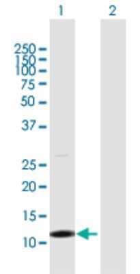 Western Blot: TCL1B Antibody [H00009623-D01P]