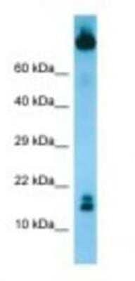 Western Blot: TCL1B Antibody [NBP1-98534]