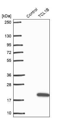 Western Blot: TCL1B Antibody [NBP2-47608]