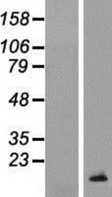 Western Blot: TCL1B Overexpression Lysate [NBL1-16781]