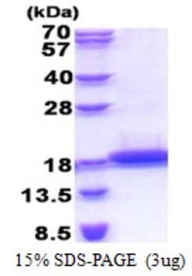 SDS-PAGE: Recombinant Human TCL1B His Protein [NBP2-22854]