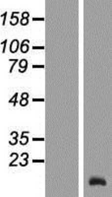 Western Blot: TCL6 Overexpression Lysate [NBL1-16782]