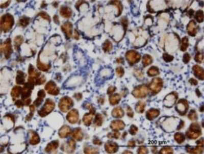 Immunohistochemistry-Paraffin: TCN1 Antibody (3F10) [H00006947-M12]