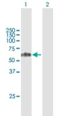 Western Blot: TCN1 Antibody [H00006947-B01P]