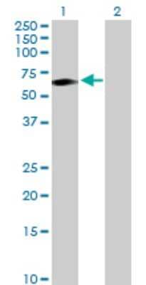 Western Blot: TCN1 Antibody [H00006947-D01P]