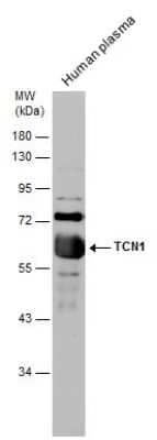 Western Blot: TCN1 Antibody [NBP3-12905]