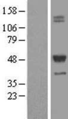 Western Blot: Transcobalamin II Overexpression Lysate [NBL1-16784]