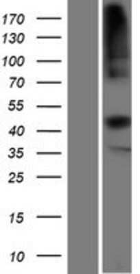 Western Blot: Transcobalamin II Overexpression Lysate [NBP2-10251]