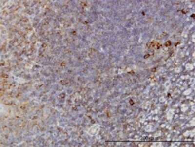 Immunohistochemistry-Paraffin: TCP1 alpha Antibody (2B2-D6) [H00006950-M01]