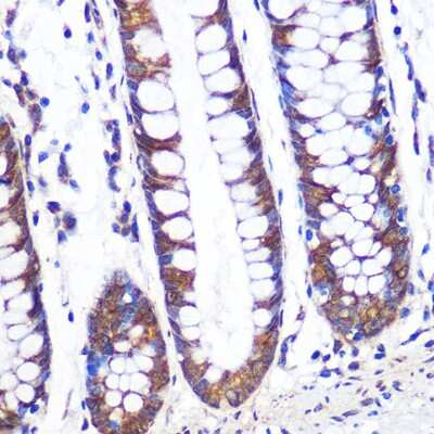Immunohistochemistry-Paraffin: TCP1 alpha Antibody (3G9G8) [NBP3-16290]