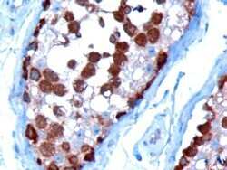 Immunohistochemistry-Paraffin: TCP1 alpha Antibody [NB100-1400]