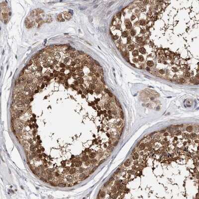 Immunohistochemistry-Paraffin: TCP1 alpha Antibody [NBP1-88149]