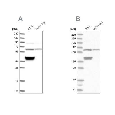 Western Blot: TCP1 alpha Antibody [NBP1-88149]