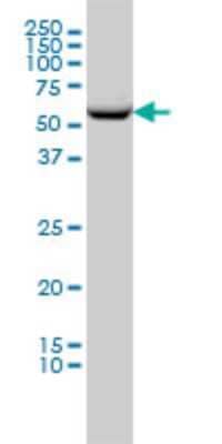 Western Blot: TCP1-beta Antibody (2G6) [H00010576-M01]