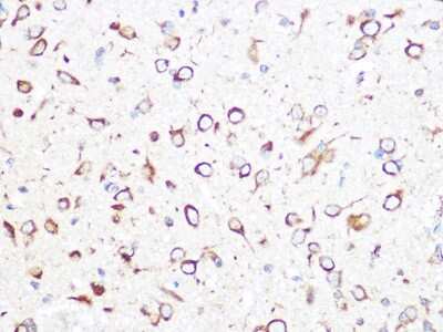 Immunohistochemistry-Paraffin: TCP1-beta Antibody (9N6B4) [NBP3-16465]