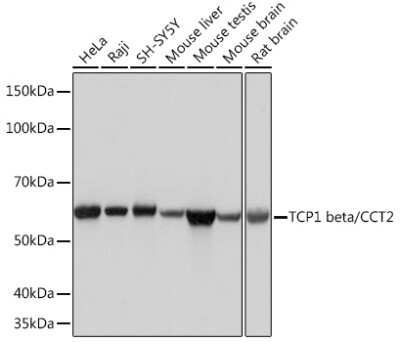 Western Blot: TCP1-beta Antibody (9N6B4) [NBP3-16465]