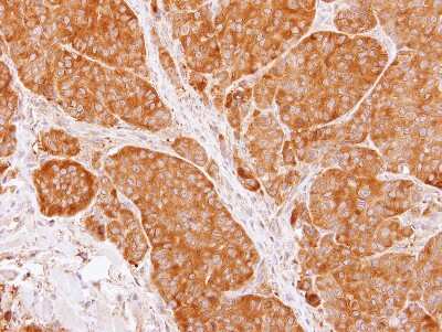 Immunohistochemistry-Paraffin: TCP1-beta Antibody [NBP1-33418]