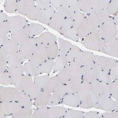 Immunohistochemistry-Paraffin: TCP1-beta Antibody [NBP1-88146]