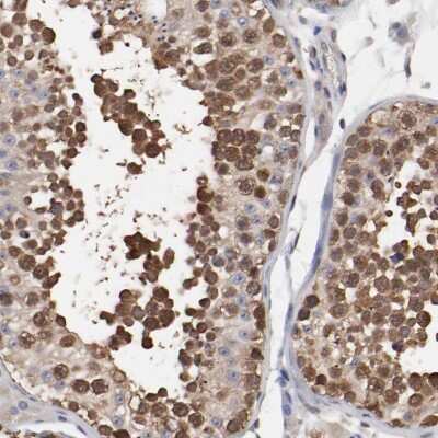 Immunohistochemistry-Paraffin: TCP1-beta Antibody [NBP1-88146]