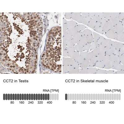 Immunohistochemistry-Paraffin: TCP1-beta Antibody [NBP1-88146]