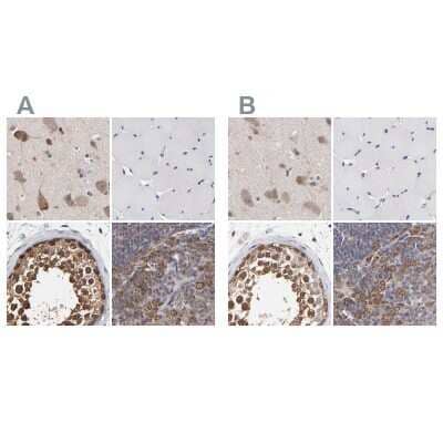 Immunohistochemistry-Paraffin: TCP1-beta Antibody [NBP1-88146]
