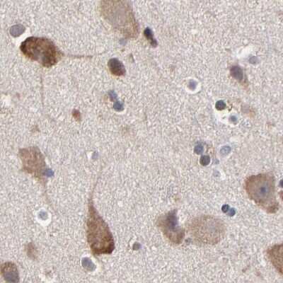 Immunohistochemistry-Paraffin: TCP1-beta Antibody [NBP1-88146]