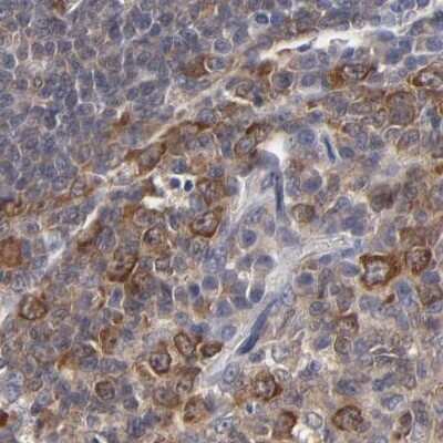 Immunohistochemistry-Paraffin: TCP1-beta Antibody [NBP1-88146]