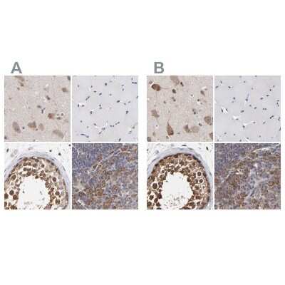 Immunohistochemistry-Paraffin: TCP1-beta Antibody [NBP1-88147]